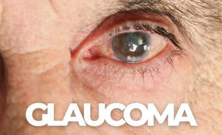Glaucoma Explained: Symptoms, Causes, and How to Protect Your Vision