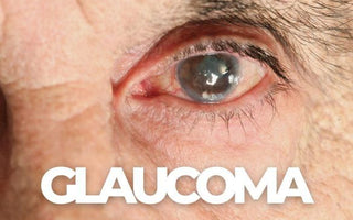 Glaucoma Explained: Symptoms, Causes, and How to Protect Your Vision - Wickramarachchi Opticians