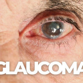 Glaucoma Explained: Symptoms, Causes, and How to Protect Your Vision